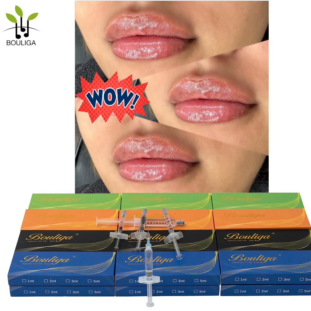 Bouliga Hautfüller 2 ml zur Behandlung von Lippen und Falten